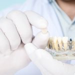 Implantologia zębowa w Szczecinie